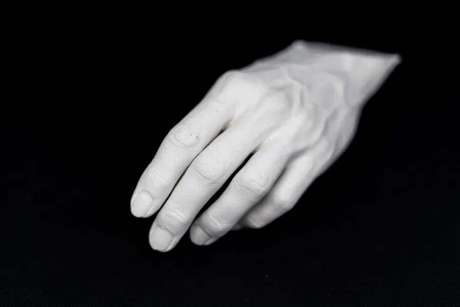 Plaster cast of a relaxed hand on a black background